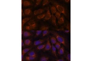 anti-CAMP Responsive Element Binding Protein 3 (CREB3) (AA 1-230) antibody