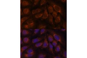 Immunofluorescence analysis of U-2 OS cells using CREB3 antibody (ABIN6128862, ABIN6139013, ABIN6139015 and ABIN6222241) at dilution of 1:100.