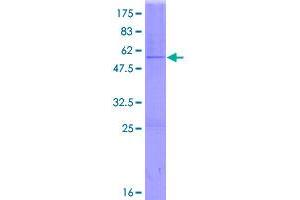 Image no. 1 for Glutathione S-Transferase alpha 2 (GSTa2) (AA 1-222) protein (GST tag) (ABIN1306061)