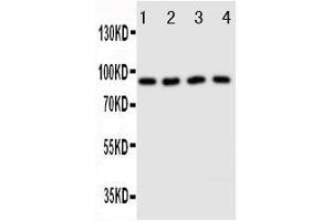 Anti-Cullin3 antibody, Western blotting Lane 1: HELA Cell Lysate Lane 2: MCF-7 Cell Lysate Lane 3: Rat Testis Tissue Lysate Lane 4: Rat Brain Tissue Lysate (Cullin 3 anticorps  (Middle Region))