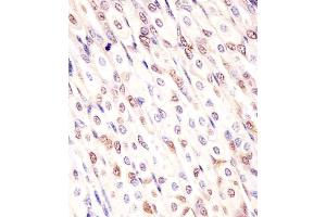 (ABIN6242936 and ABIN6578146) staining Mouse Med12 in mouse stomach sections by Immunohistochemistry (IHC-P - paraformaldehyde-fixed, paraffin-embedded sections). (MED12 anticorps  (C-Term))