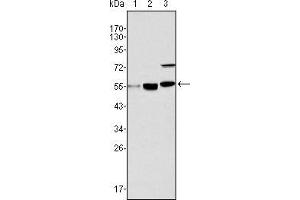 Western blot analysis using MYST1 mouse mAb against Hela (1), HepG2 (2) and SMMC-7721 (3) cell lysate. (MYST1 anticorps)