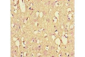 Immunohistochemistry of paraffin-embedded human brain tissue using ABIN7161278 at dilution of 1:100 (NEFL anticorps  (AA 128-271))