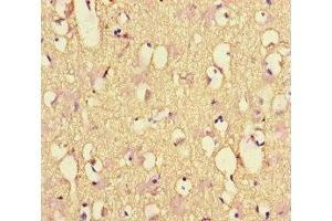 Immunohistochemistry of paraffin-embedded human brain tissue using ABIN7161278 at dilution of 1:100 (NEFL anticorps  (AA 128-271))