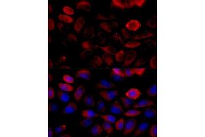 Immunofluorescence analysis of HeLa cells using FGFR2 antibody (ABIN6130457, ABIN6140615, ABIN6140617 and ABIN6216059) at dilution of 1:100 (40x lens). (FGFR2 anticorps  (AA 245-345))