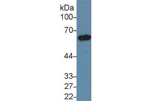 Western Blot; Sample: Rat Ovary lysate; Primary Ab: 1µg/ml Rabbit Anti-Rat KRT5 Antibody Second Ab: 0. (Cytokeratin 5 anticorps  (AA 335-473))
