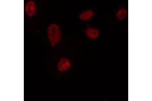 ABIN6272423 staining HepG2 by IF/ICC. (Retinoid X Receptor gamma anticorps  (Internal Region))