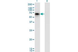 Western Blot analysis of CD44 expression in transfected 293T cell line by CD44 monoclonal antibody (M03), clone 1E1.