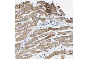 Immunohistochemical staining of human heart muscle with HHATL polyclonal antibody  shows moderate cytoplasmic positivity in myocytes at 1:10-1:20 dilution. (HHATL anticorps)