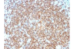 IHC testing of FFPE human tonsil tissue with CD22 antibody (clone BLCAM/1795). (CD22 anticorps  (AA 52-178))