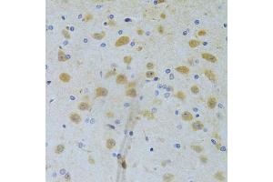 Immunohistochemistry of paraffin-embedded rat brain using CHIA Antibody (ABIN5973937) at dilution of 1/100 (40x lens). (CHIA anticorps)