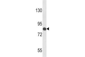 Western Blotting (WB) image for anti-Cartilage Oligomeric Matrix Protein (COMP) antibody (ABIN3002869) (COMP anticorps)