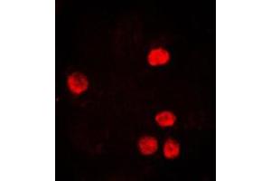 Immunofluorescent analysis of PCNA staining in HeLa cells. (PCNA anticorps  (Center))