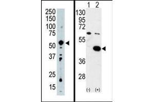 (LEFT) Western blot analysis of PDK2 Antibody (C-term) in mouse intestine tissue lysate (35ug/lane). (PDK2 anticorps  (C-Term))