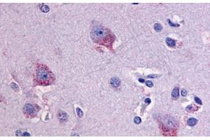 Anti-LPHN1 antibody  ABIN1049023 IHC staining of human brain, neurons and glia. (Latrophilin 1 anticorps  (C-Term))
