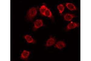 ABIN6274153 staining Hela by IF/ICC. (HEXB anticorps  (C-Term))