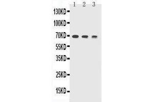 Anti-TREM1 antibody, Western blotting Lane 1: Recombinant Mouse TREM1 Protein 10ng Lane 2: Recombinant Mouse TREM1 Protein 5ng Lane 3: Recombinant Mouse TREM1 Protein 2.
