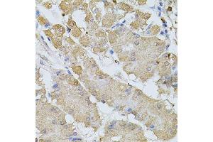 Immunohistochemistry of paraffin-embedded human stomach using BEST1 antibody.