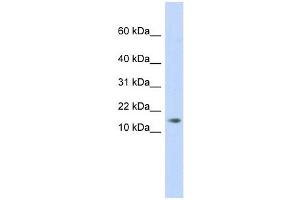 C11ORF67 antibody used at 1 ug/ml to detect target protein. (AAMDC anticorps  (Middle Region))
