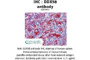 Image no. 3 for anti-DEAD (Asp-Glu-Ala-Asp) Box Polypeptide 58 (DDX58) antibody (ABIN1733572) (DDX58 anticorps)