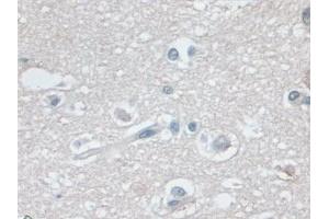 Detection of MHCB in Human Cerebrum Tissue using Polyclonal Antibody to Major Histocompatibility Complex Class I B (MHCB)