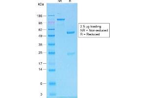 SDS-PAGE Analysis of Purified MART-1 Rabbit Recombinant Monoclonal Antibody (MLANA/1761R).