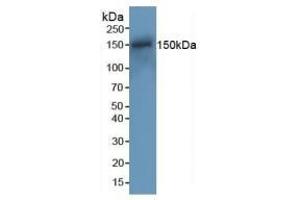 Detection of RAD50 in Mouse Spleen Tissue using Polyclonal Antibody to DNA Repair Protein RAD50 (RAD50)