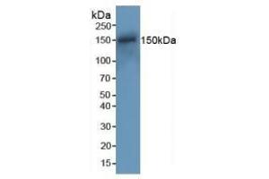 Detection of RAD50 in Mouse Spleen Tissue using Polyclonal Antibody to DNA Repair Protein RAD50 (RAD50) (RAD50 anticorps  (AA 1-234))