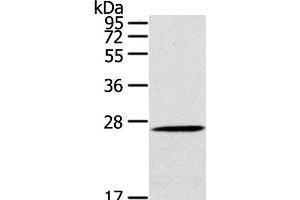 Western Blot analysis of Mouse liver tissue using CLEC4A Polyclonal Antibody at dilution of 1:100 (CLEC4A anticorps)