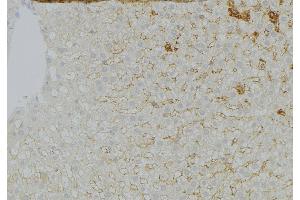 ABIN6272961 at 1/100 staining Mouse liver tissue by IHC-P.