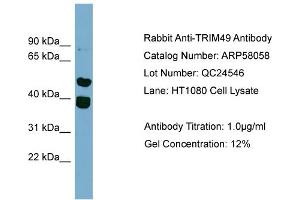 WB Suggested Anti-TRIM49  Antibody Titration: 0. (TRIM49 anticorps  (Middle Region))