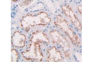 IHC-P analysis of Kidney tissue, with DAB staining. (Nephrin anticorps  (AA 705-1055))