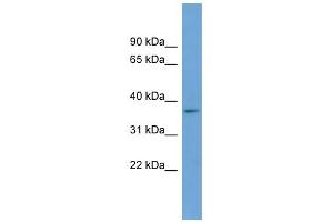 WB Suggested Anti-BACE2 Antibody Titration:  0.