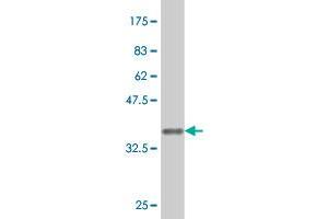 Western Blot detection against Immunogen (37.