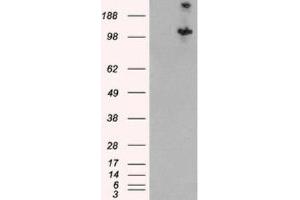 Western Blotting (WB) image for anti-Tuberous Sclerosis 1 (TSC1) (C-Term) antibody (ABIN2466406) (TSC1 anticorps  (C-Term))