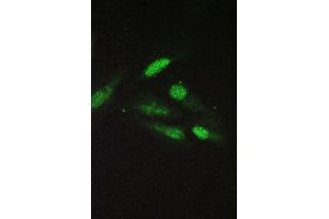 IF analysis of SRI using anti-SRI antibody (ABIN6719388) SRI was detected in immunocytochemical section of U20S cell.