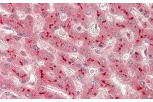 Detection of ADAM10 in Human Liver Tissue using Polyclonal Antibody to A Disintegrin And Metalloprotease 10 (ADAM10)