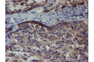 Image no. 3 for anti-Zinc Finger Protein 365 (ZNF365) (AA 108-407) antibody (ABIN1490829)