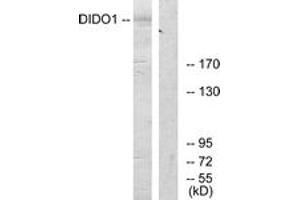 Western blot analysis of extracts from 293 cells, using DIDO1 Antibody. (DIDO1 anticorps  (AA 161-210))