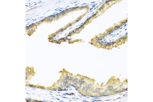 Immunohistochemistry of paraffin-embedded human prostate using PENK antibody. (Enkephalin anticorps)