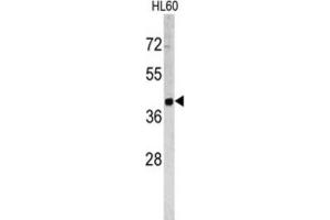 Western Blotting (WB) image for anti-Tumor-Associated Calcium Signal Transducer 2 (TACSTD2) antibody (ABIN3002746)