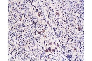 Formalin-fixed and paraffin embedded rat transplant lymphoma labeled with Anti-Caspase-1 Polyclonal Antibody, Unconjugated  at 1:200 followed by conjugation to the secondary antibody and DAB staining (Caspase 1 (p10) anticorps  (AA 320-404))