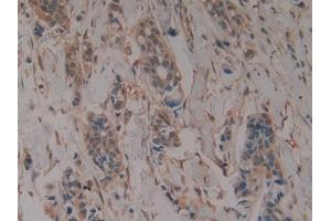 DAB staining on IHC-P; Samples: Human Stomach Tissue) (GLA anticorps  (AA 81-429))