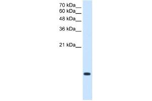 WB Suggested Antibody Titration:  2.