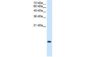 WB Suggested Antibody Titration:  2. (BRK1 anticorps  (Middle Region))