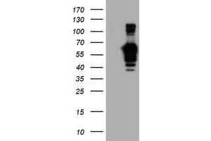 Western Blotting (WB) image for anti-Golgi Membrane Protein 1 (GOLM1) antibody (ABIN1498494) (GOLM1 anticorps)