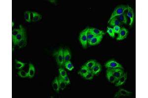 Immunofluorescence staining of HepG2 cells with ABIN7157976 at 1:100, counter-stained with DAPI. (LEMD1 anticorps  (AA 44-151))