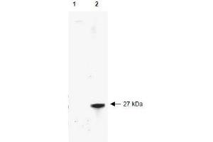 Image no. 1 for anti-Red Fluorescent Protein (RFP) antibody (ABIN401229)