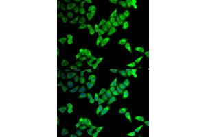 Immunofluorescence analysis of U2OS cells using TRIP10 antibody.