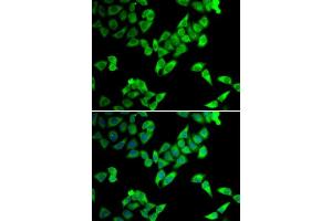 Immunofluorescence analysis of U2OS cells using TRIP10 antibody. (TRIP10 anticorps  (AA 246-545))